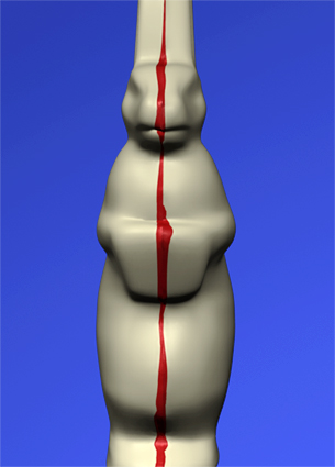 Osterhase